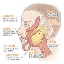 イメージ図：フェイスシェイプ術